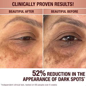 Charlotte Tilbury Dark Spot Correcting Radiance Recovery Serum 10ml